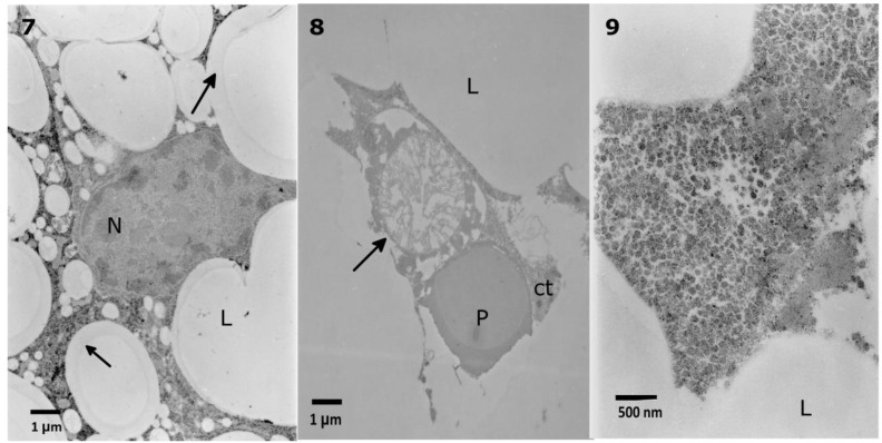 Figure 11