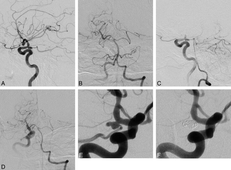 Fig 2.