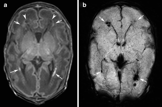 Fig. 4