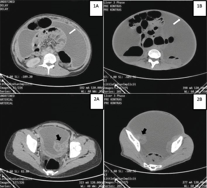 Fig. 2