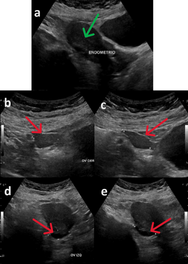 Figure 5