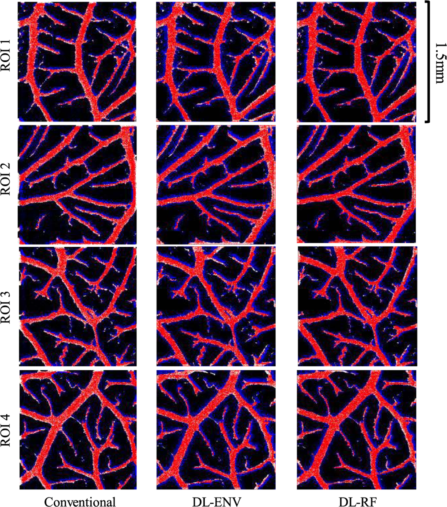 Fig. 11.