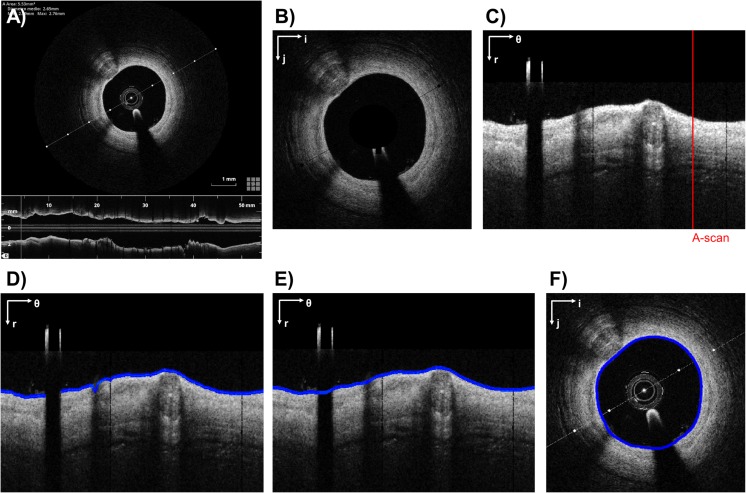 Fig. 2