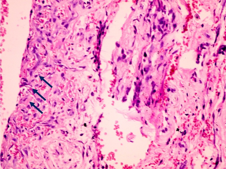 Figure 1. Slide with thick cambium layer (Blue arrows).