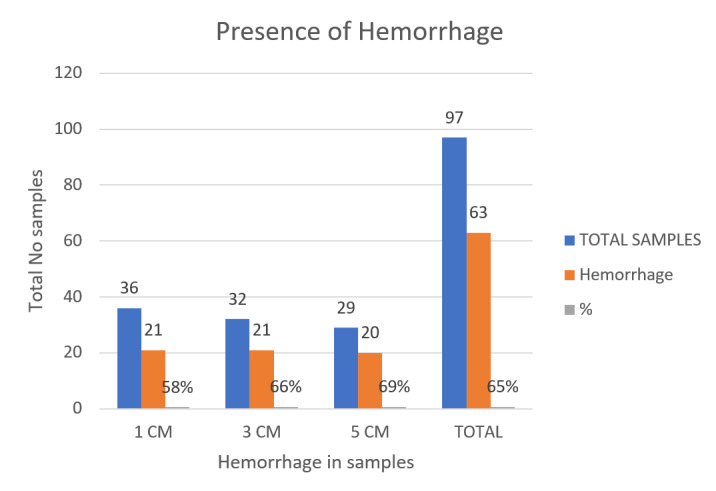 Chart 1. Presence of Haemorrhage in periosteum Samples.