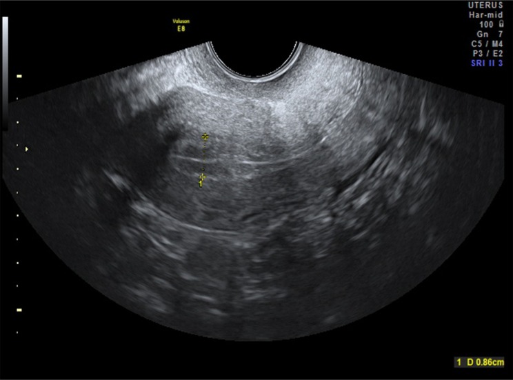 Fig. 1