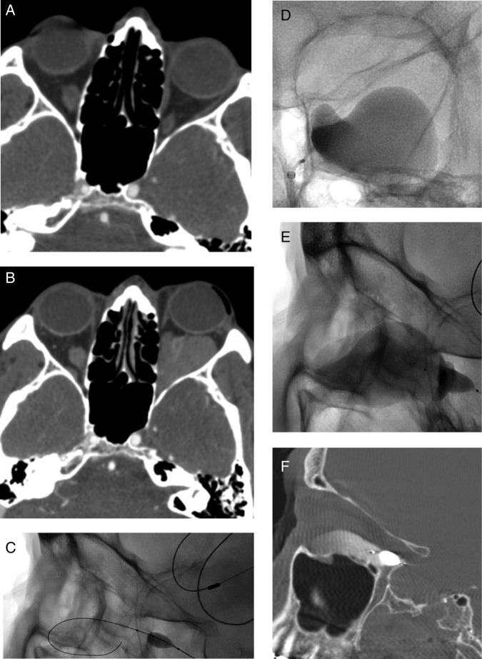 Figure 2