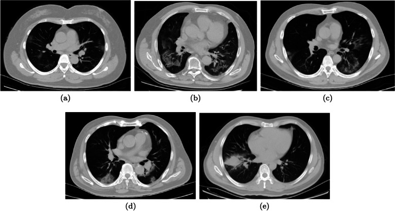 Fig. 2