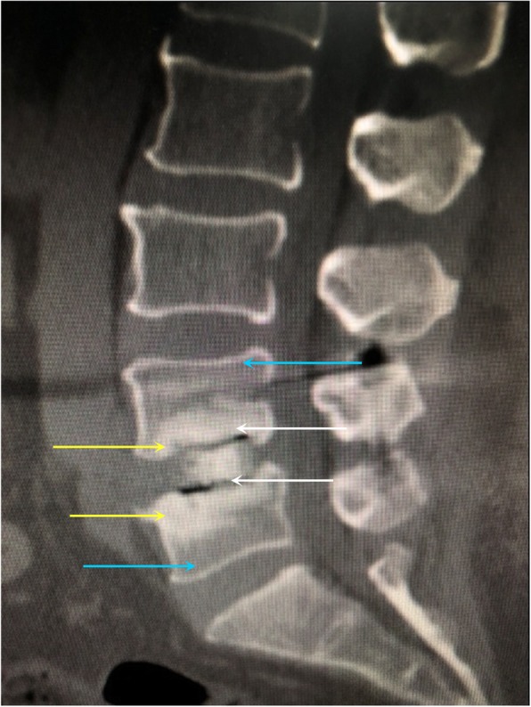 Fig. 5