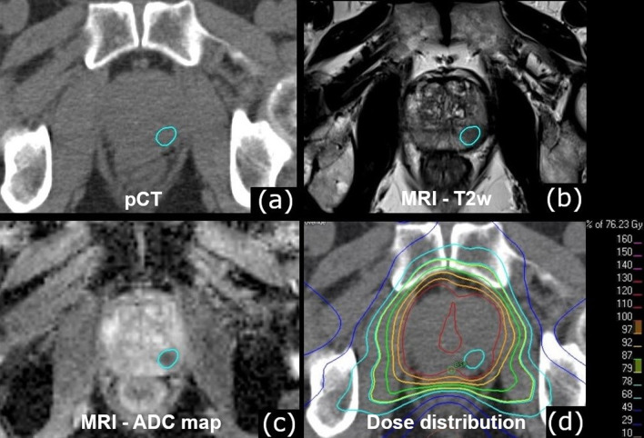 Fig. 1