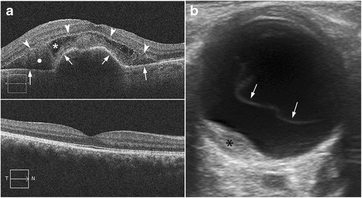 Fig. 23