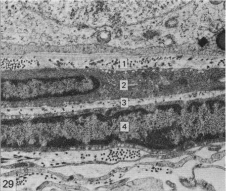 Fig. 29