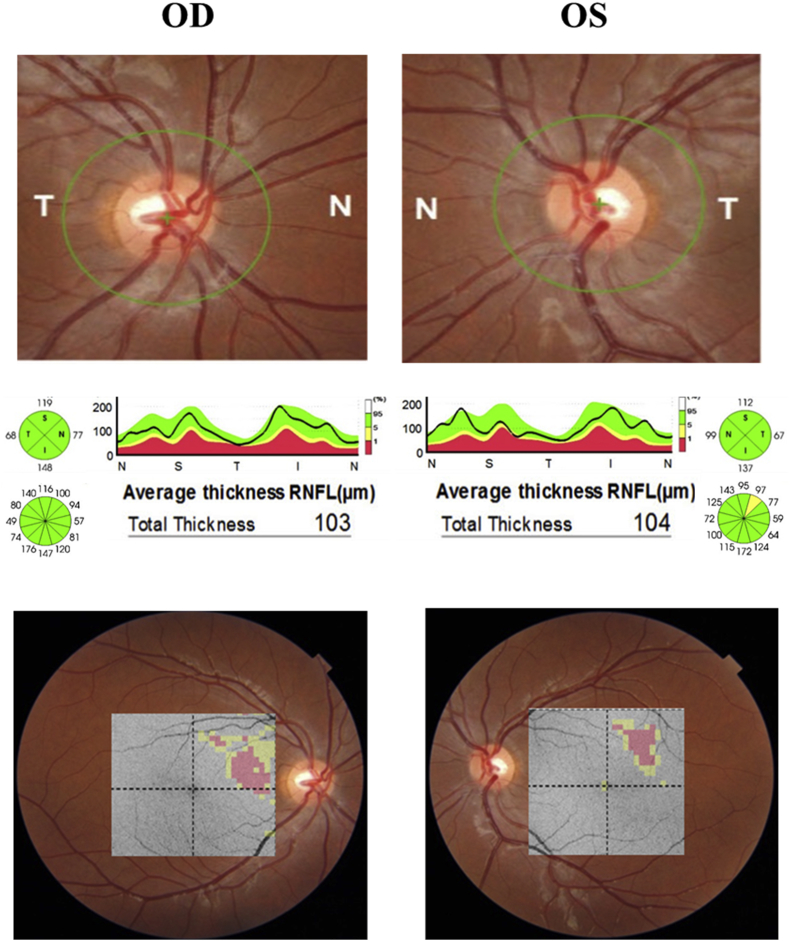 Fig. 2