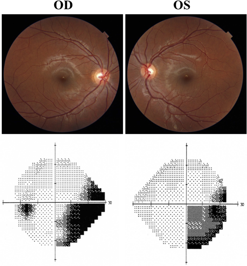 Fig. 1