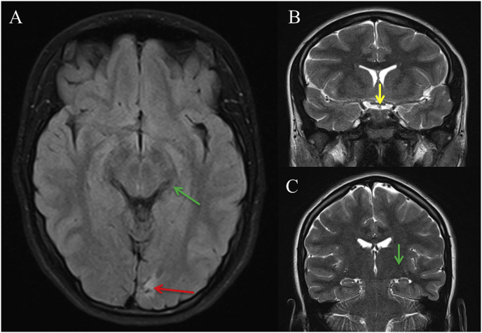 Fig. 3