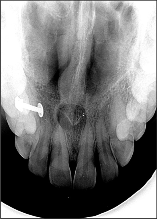 Fig. 1