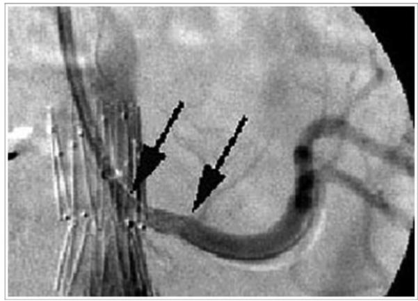 Figure 3b