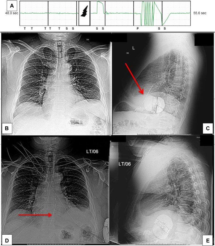 Figure 1