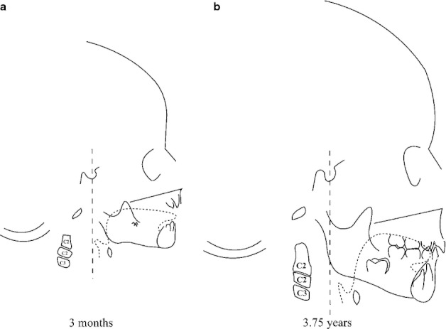 Fig. 9