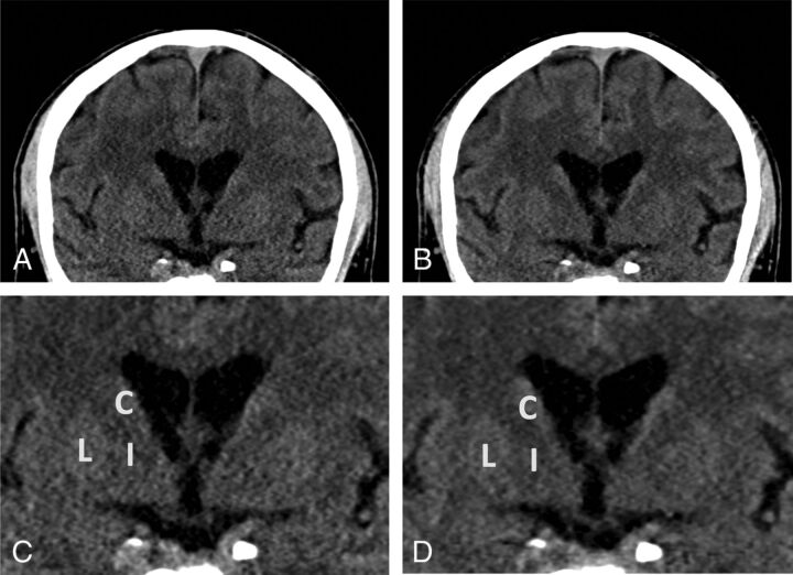 Fig 4.