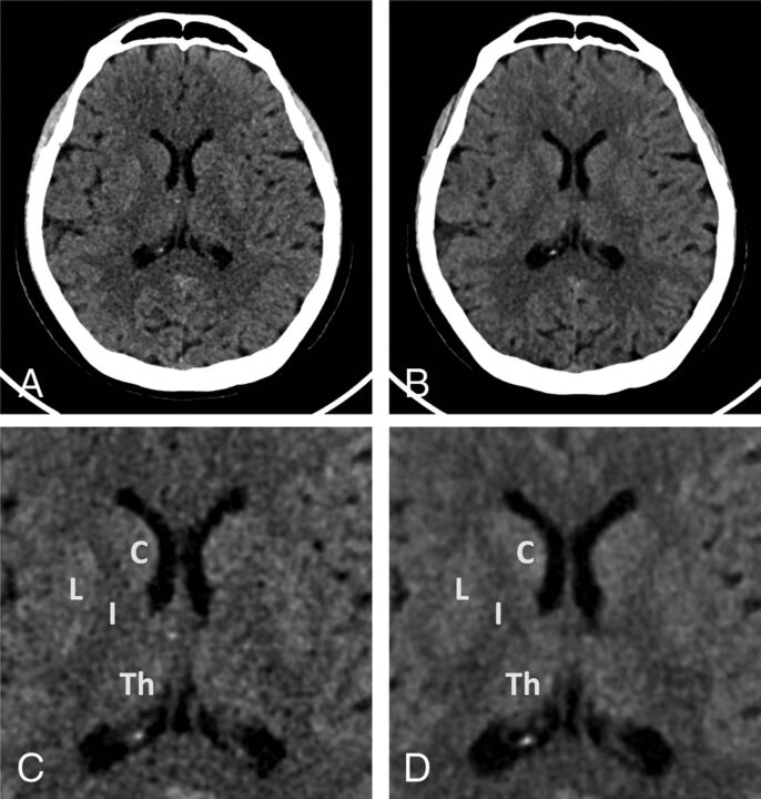 Fig 3.