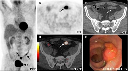 Fig. 1