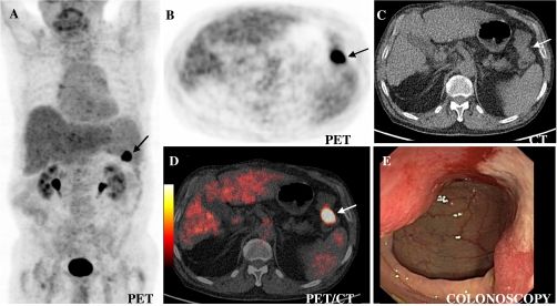 Fig. 2