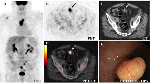 Fig. 3