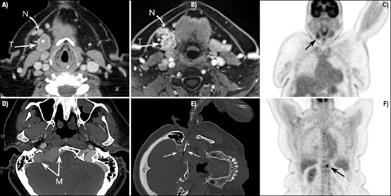 Figure 4.5.