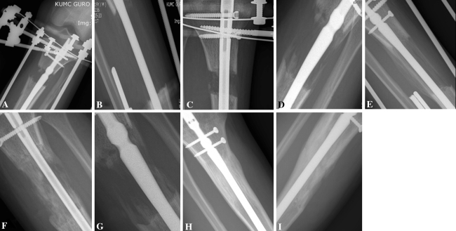 Fig. 1A–I