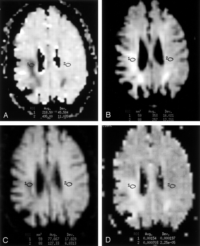 Fig 6.