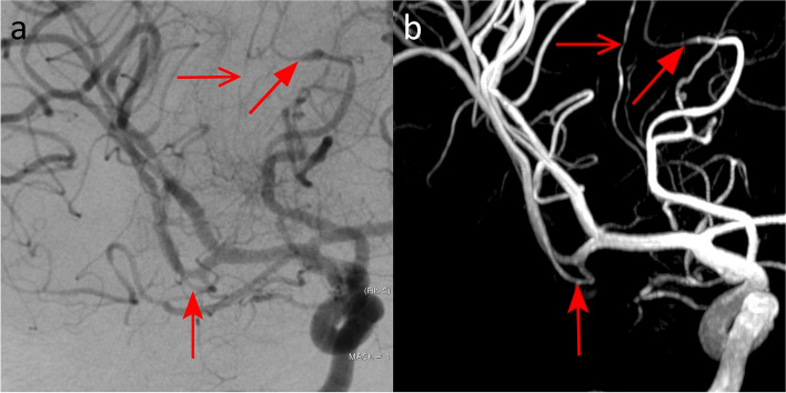 Fig. 4