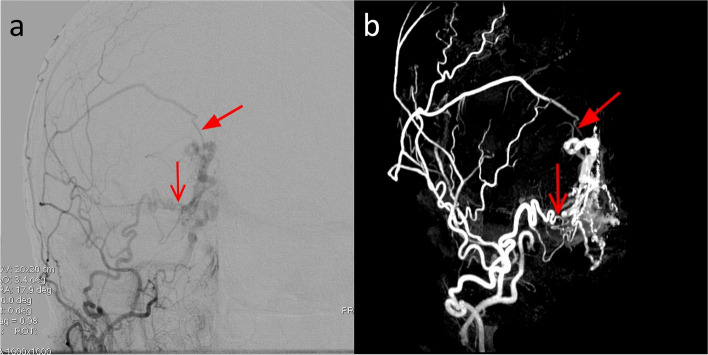 Fig. 8