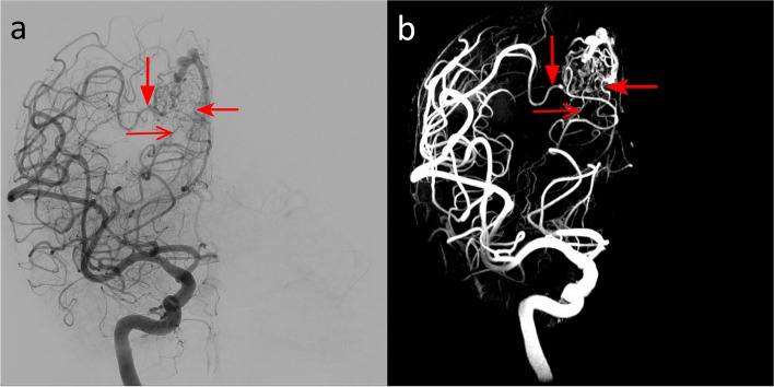 Fig. 7