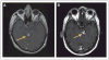 Fig 5