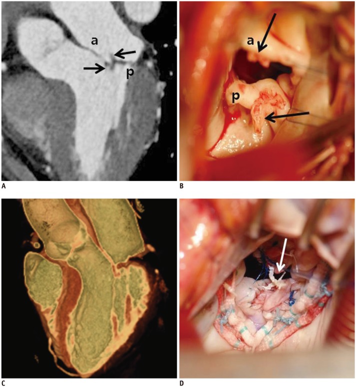 Fig. 11