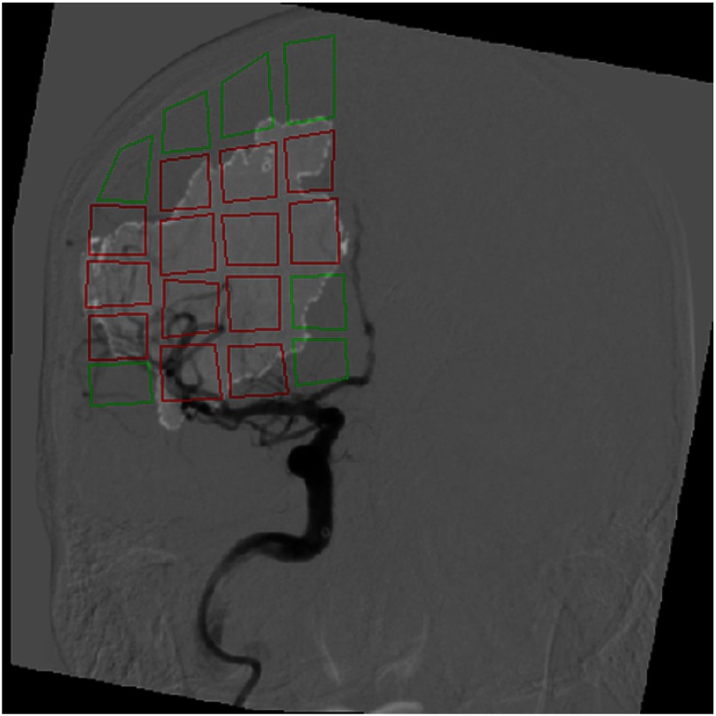 Fig. 13