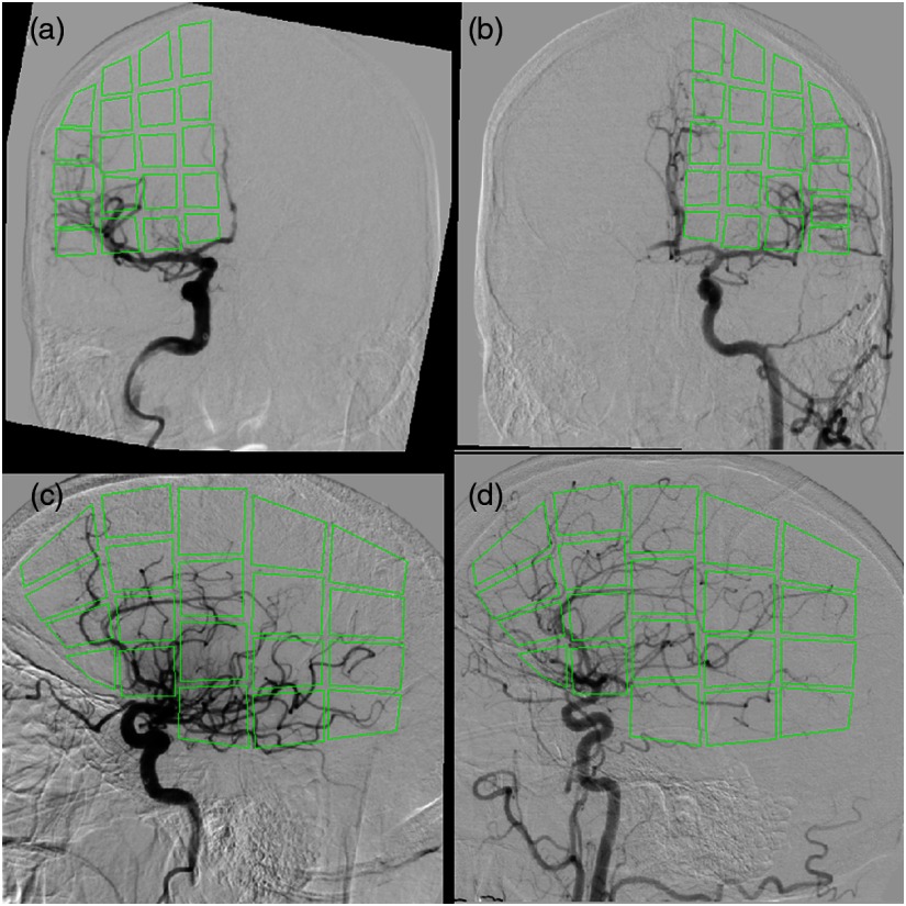 Fig. 4