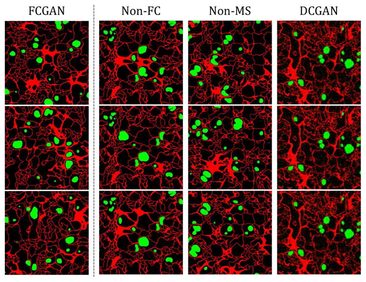 Figure 11