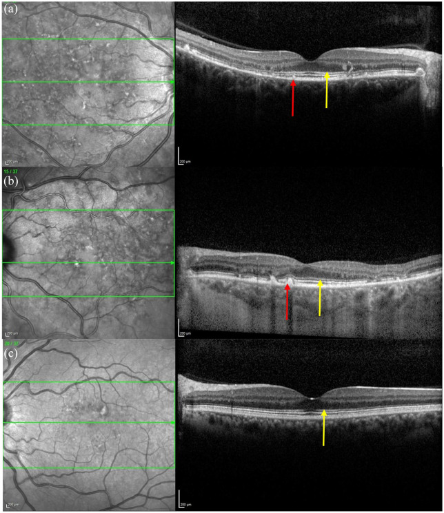 Figure 14.