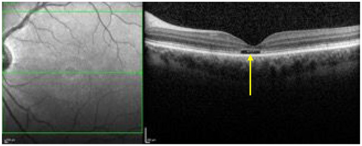 Figure 15.