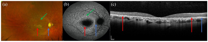 Figure 1.