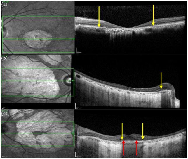 Figure 13.