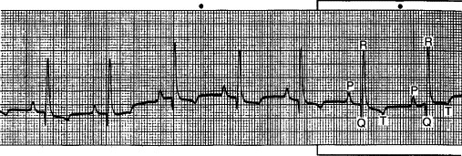 Figure 4-26