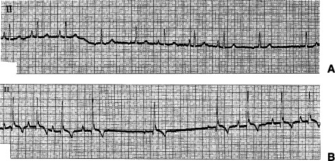 Figure 4-28