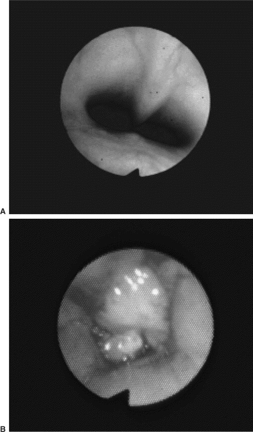 Figure 4-34