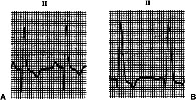 Figure 4-29