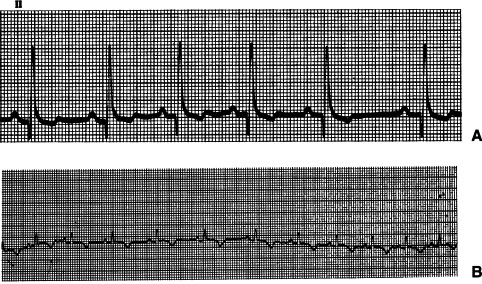 Figure 4-27