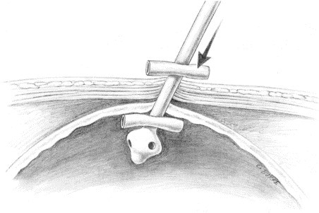 Figure 4-44