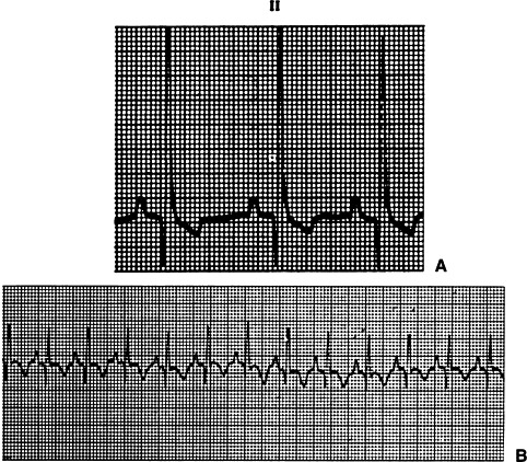 Figure 4-30